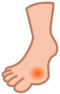 尿酸結晶がたまりやすい足の親指のつけ根部分